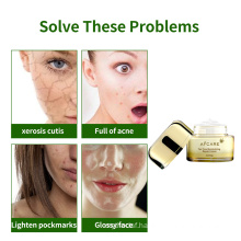 Hot Selling Products Herbal Cream Tea Tree Oil Acne Moist Cream for Women Skin Face Cream Collagen Antiaging